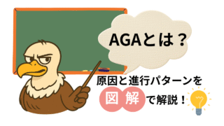 AGAとは？原因と進行パターンを図解で解説